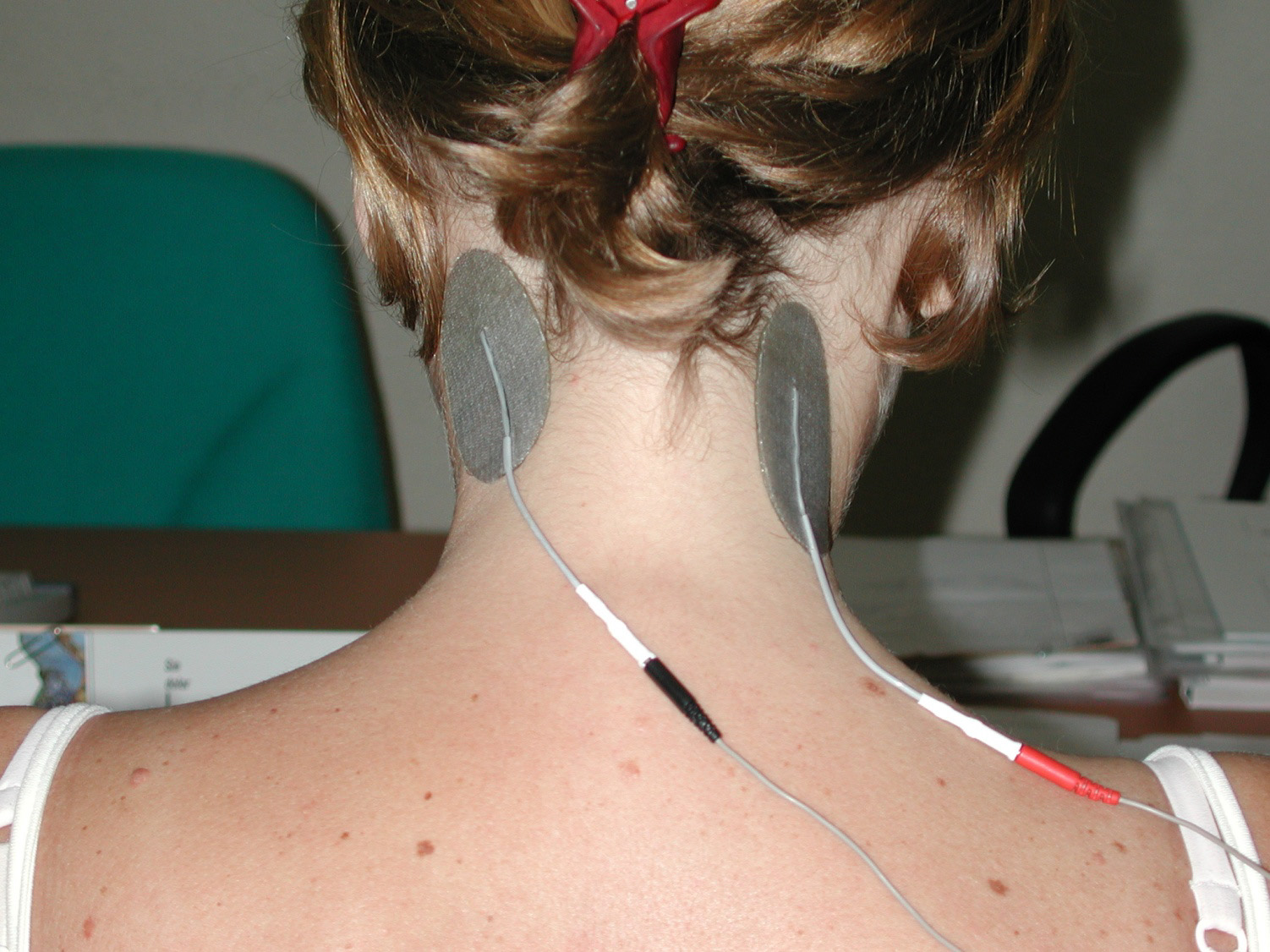 Colocación electrodos TENS para dolor de antebrazo  Electroestimulación  TENS para terapia del dolor 