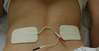 Colocación electrodos TENS para dolor de rodilla  Electroestimulación TENS  para terapia de dolor 