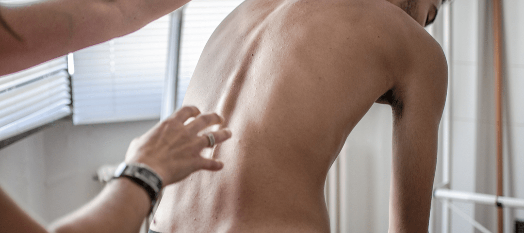 Dolor en la espalda alta: 9 causas